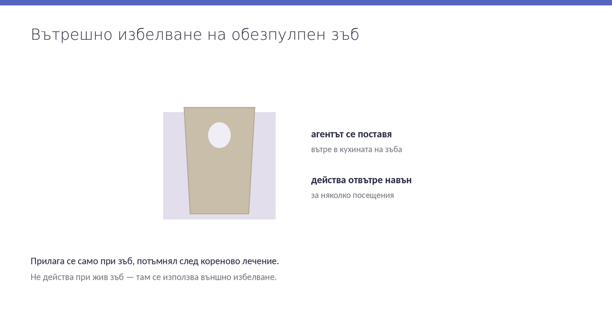 Принцип на вътрешното избелване при обезпулпен зъб